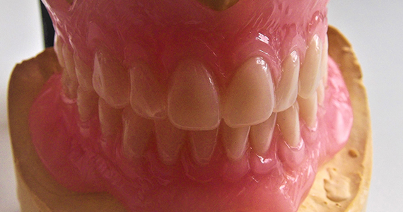 Dentures